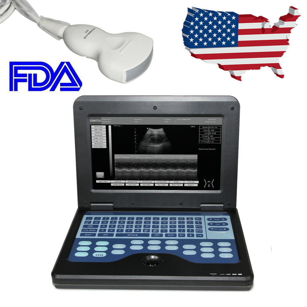 Portable Ultrasound Machine CONTEC CMS600P2 Ultrsound scanner LAPTOP with Probe