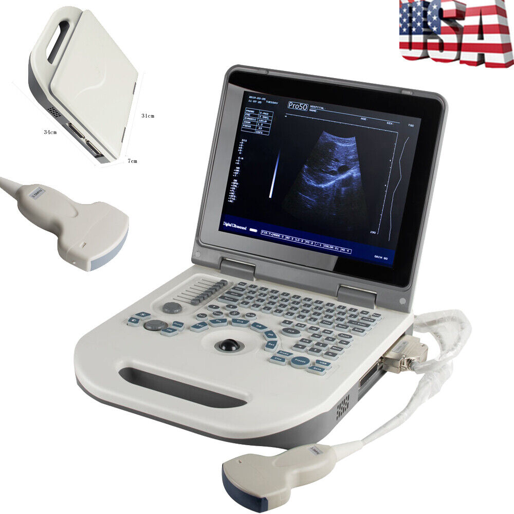 Portable Laptop Digital Ultrasound Scanner + Convex / Transvaginal /Linear Probe