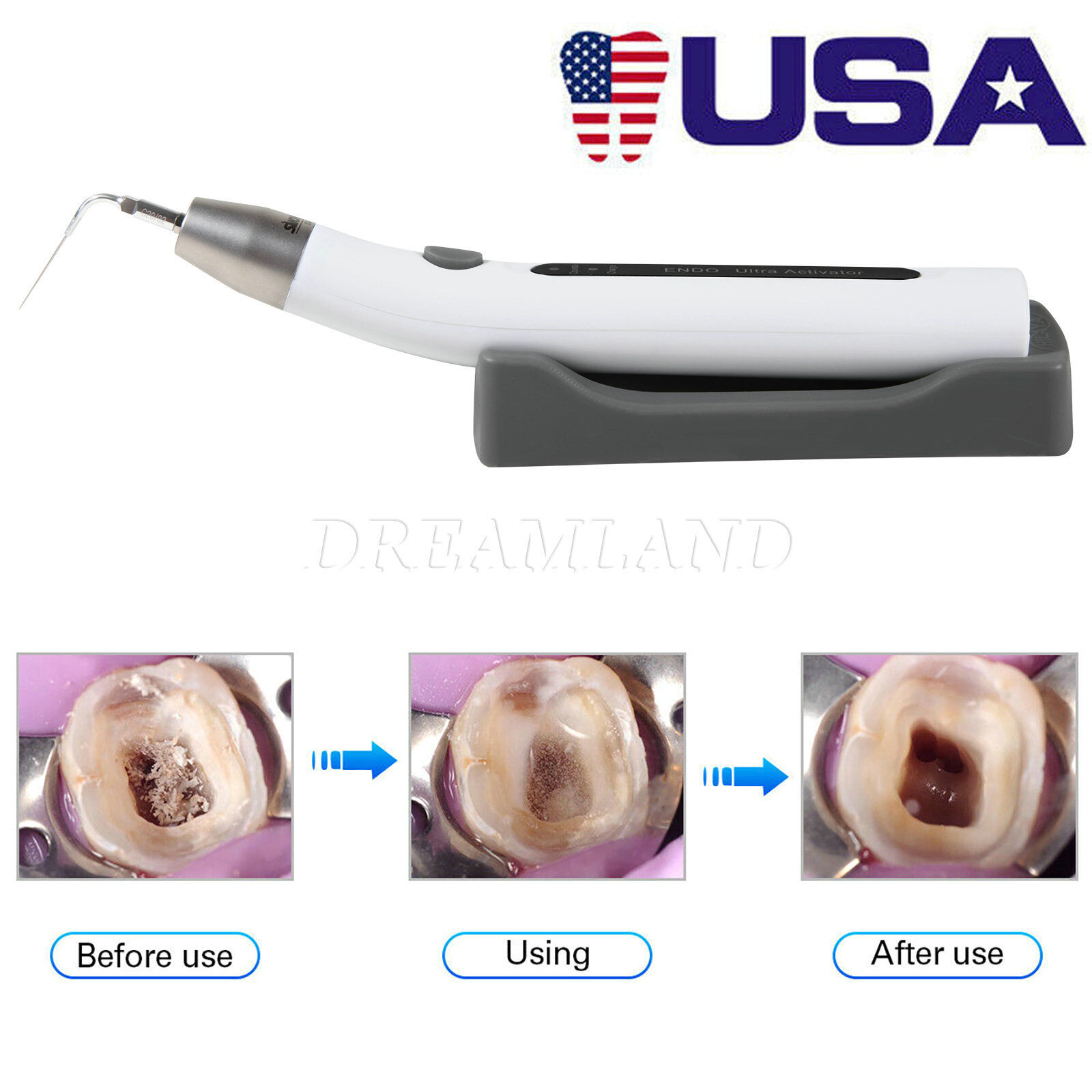 Dental Endo Ultra Activator Ultrasonic Endo Irrigator Root Canal Handpiece Tip