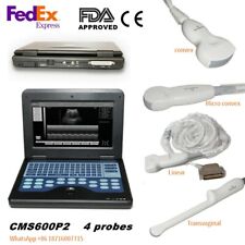 Portable Laptop Machine Digital Ultrasound Scanner 4 Probes Optional,CE FDA New picture