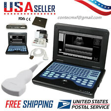 FDA CMS600P2 Portable Ultrasound Scanner Laptop Machine with 3.5Mhz Convex Probe picture