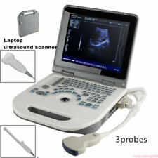 Portable Laptop Digital Ultrasound Scanner + Convex / Transvaginal /Linear Probe picture