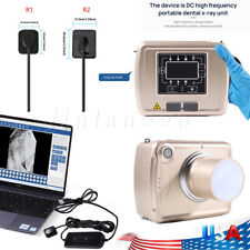 Dental Xray Digital Imaging System Unit Xray Machine/RVG X-Ray Sensor Size 1/1.5 picture