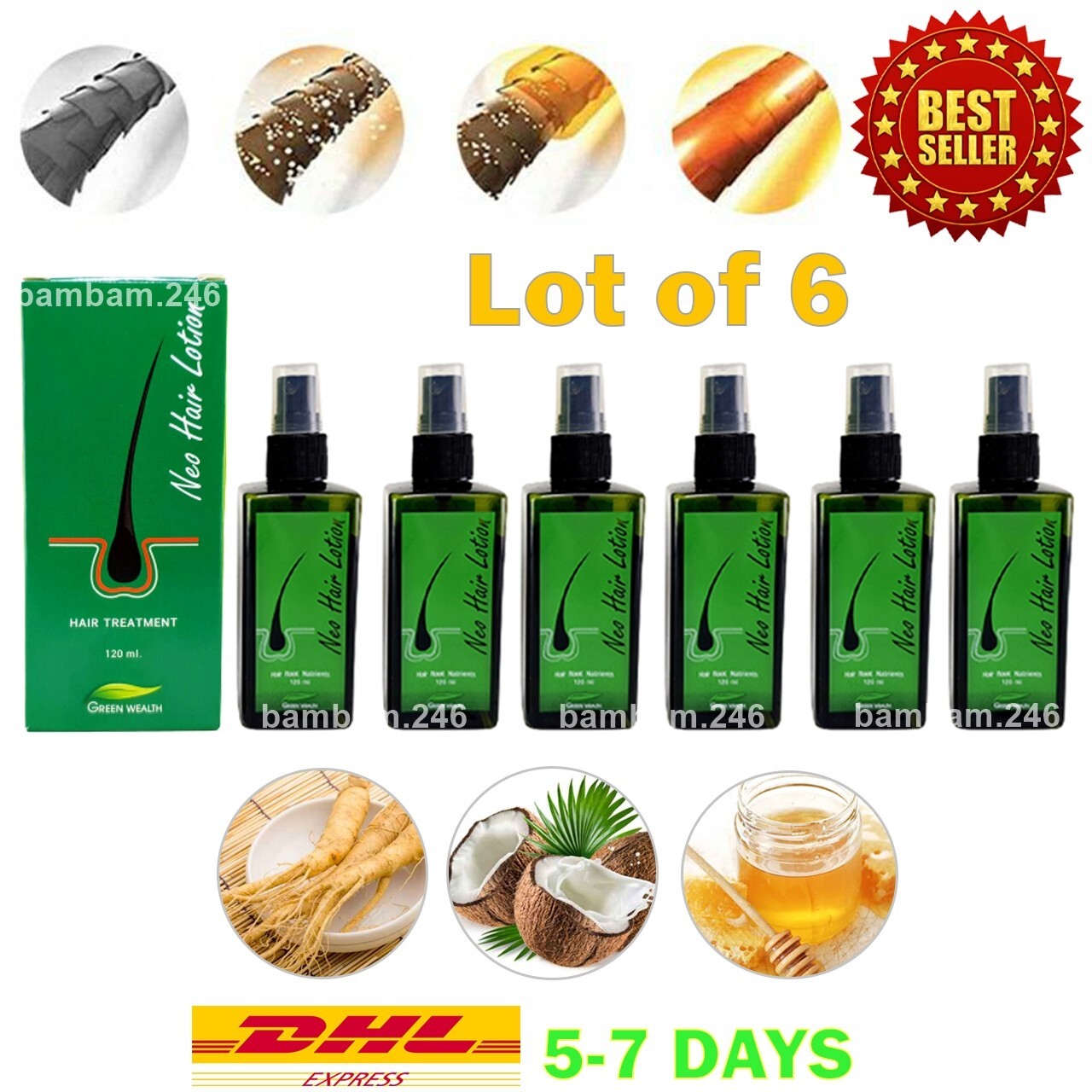 6x Original Neo Hair Lotion Root Treatment Nutrients Longer Hair Herbal Natural