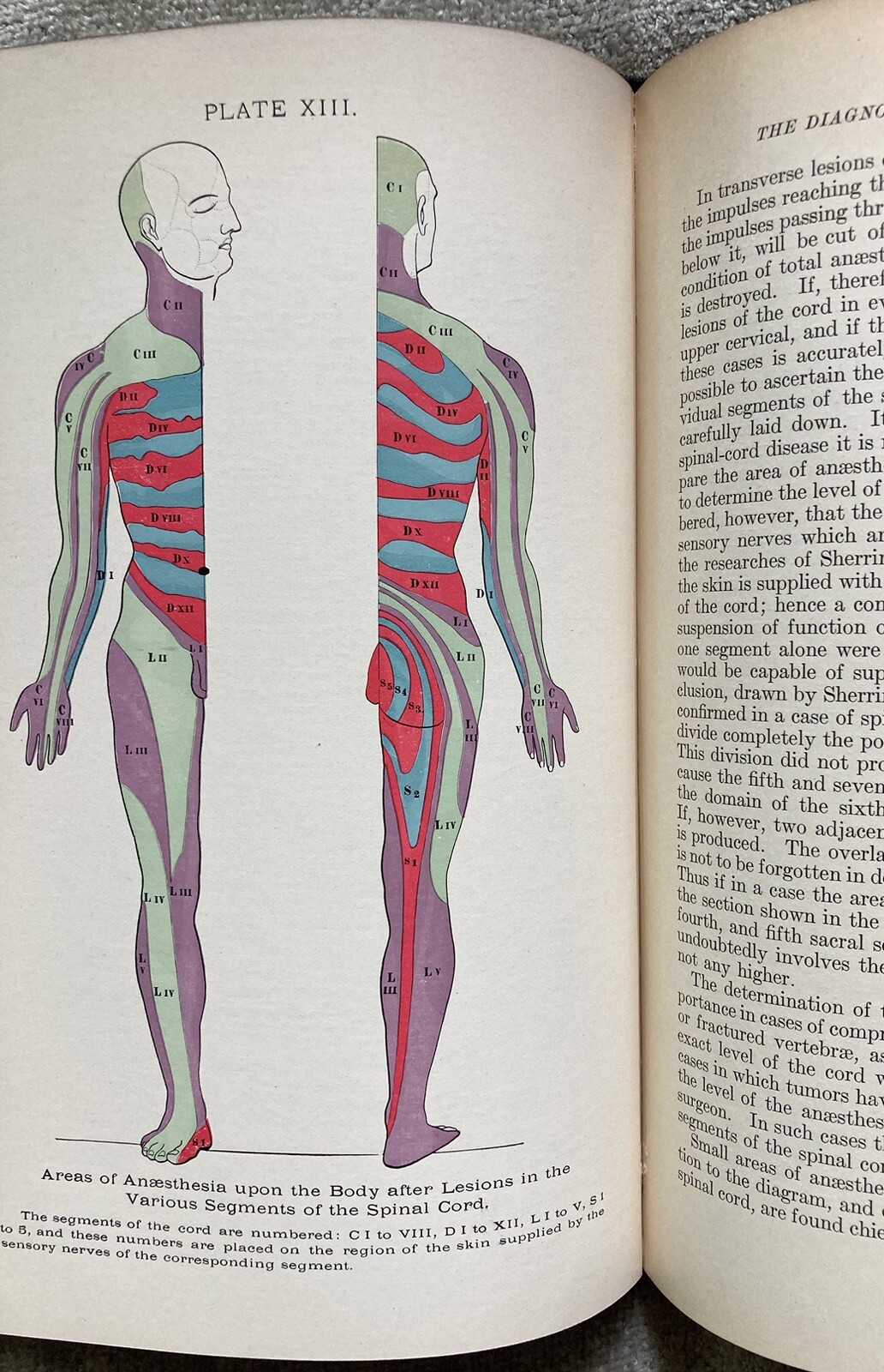 Organic Nervous Diseases, Early Neurology, Collectable, 1st. Ed., Starr, 1903 Organic Nervous Diseases, Early Neurology, Collectable, 1st. Ed., Starr, 1903