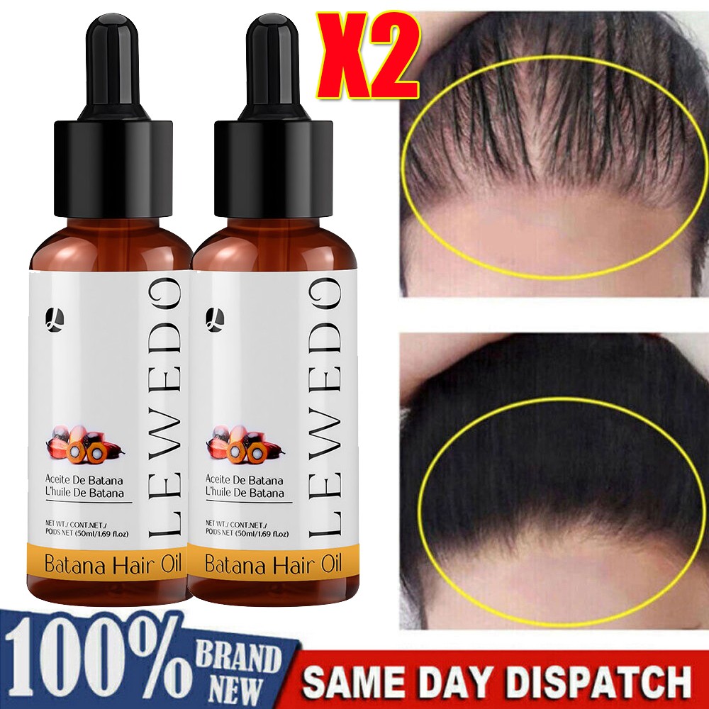 2Pcs Batana Oil Serum for Hair Growth, Batana Oil Essence, Repair Damaged Hair 2Pcs Batana Oil Serum for Hair Growth, Batana Oil Essence, Repair Damaged Hair