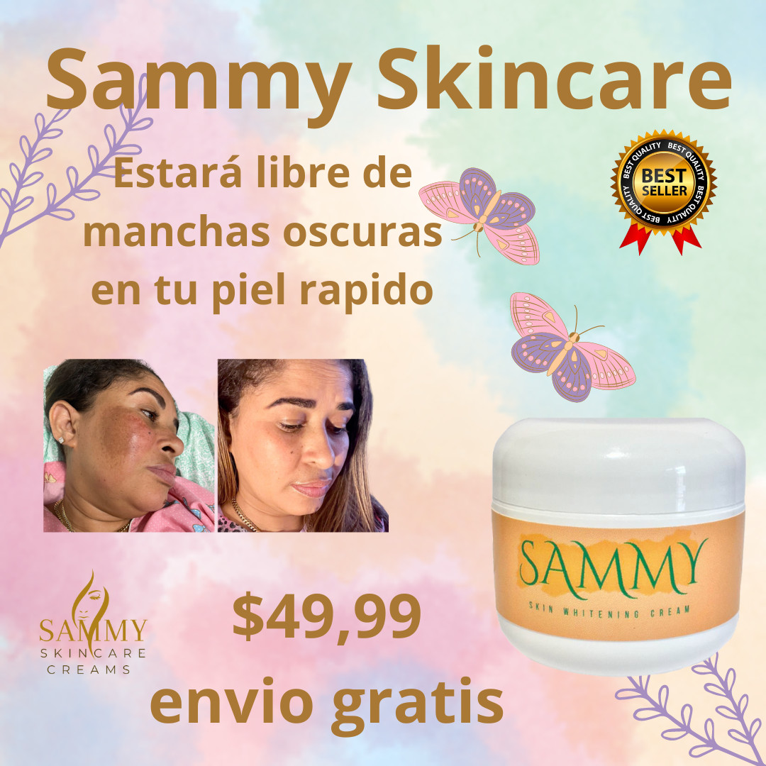 SKIN LIGHTENING TREATMENT: TRATAMIENTO EFECTIVO PARA BORRAR MANCHAS OSCURAS, 2oz SKIN LIGHTENING TREATMENT: TRATAMIENTO EFECTIVO PARA BORRAR MANCHAS OSCURAS, 2oz