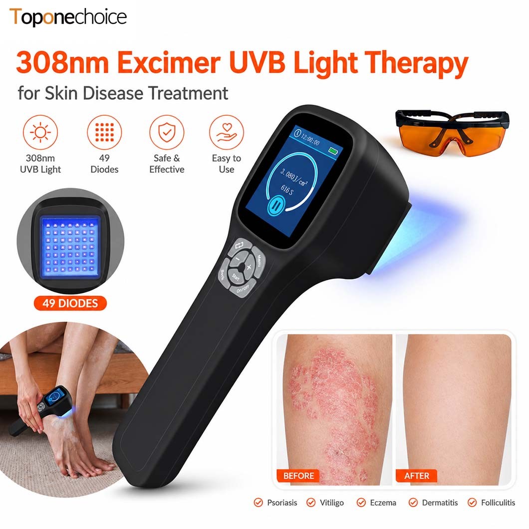 308nm Narrowband UVB Phototherapy Device for Skin Therapy Non Invasive 49 Diodes