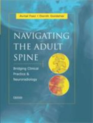NAVIGATING THE ADULT SPINE: BRIDGING CLINICAL PRACTICE AND By Fast Avital Md