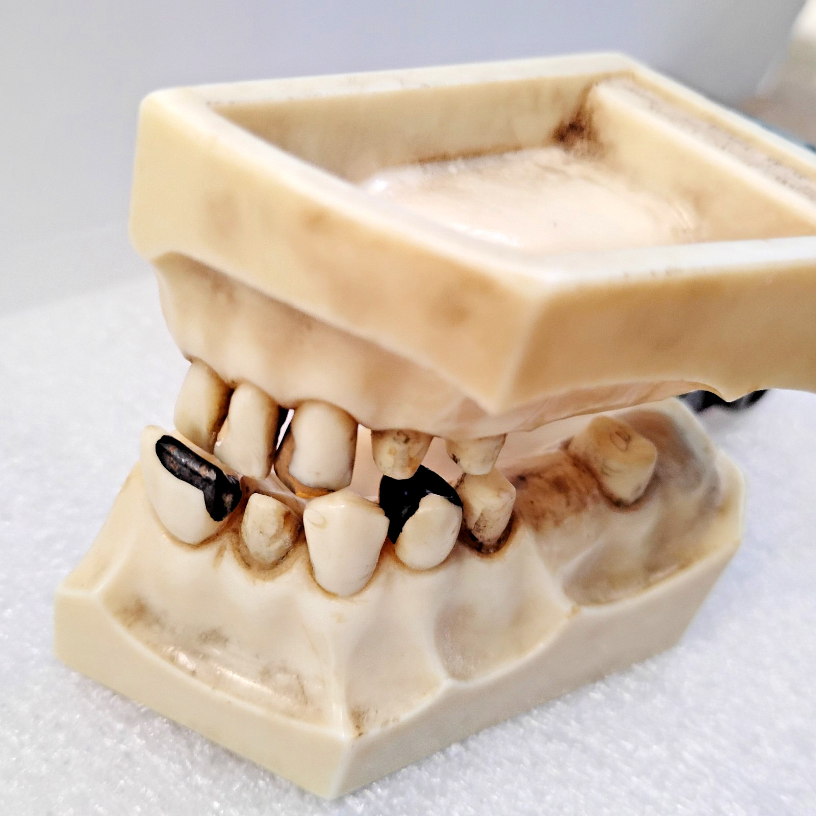 Vintage Columbia Dentoform Ivorine Dental w/ Gold Tooth & Other Metals