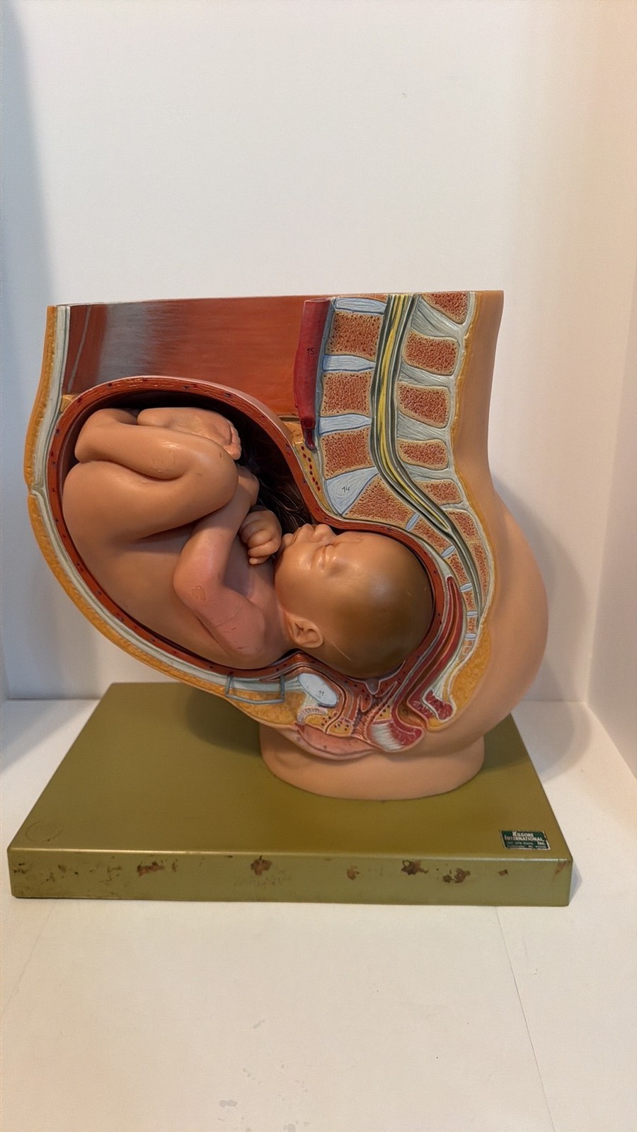 Vintage Kilgore International Pregnancy Anatomical Model Cross Section