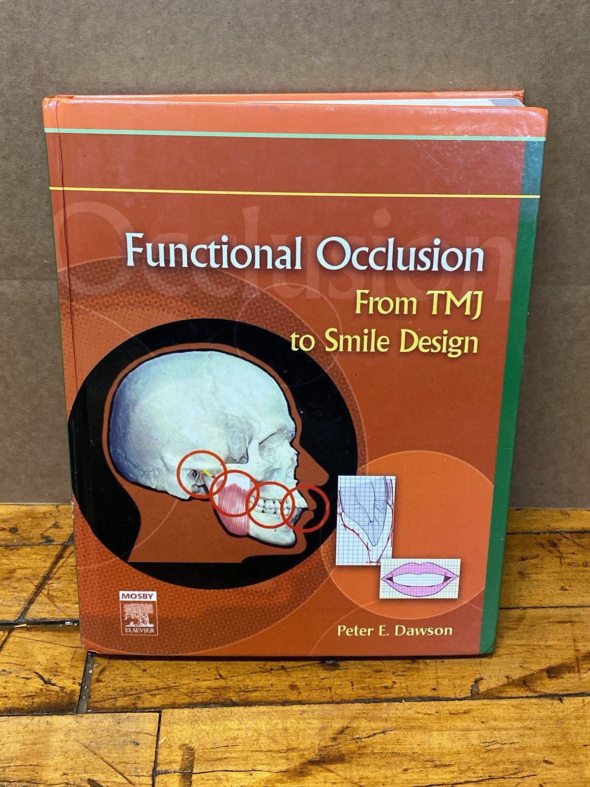 Functional Occlusion From TMJ to Smile Design Peter E Dawson Hardcover 2007