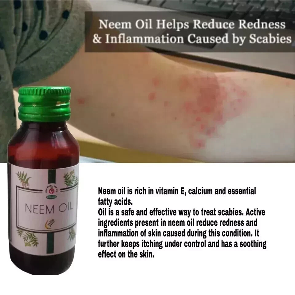 10xANTI SCABIES KILLS SCABIES MITES AND EGG COMPLETE ERADICATION oil 10xANTI SCABIES KILLS SCABIES MITES AND EGG COMPLETE ERADICATION oil