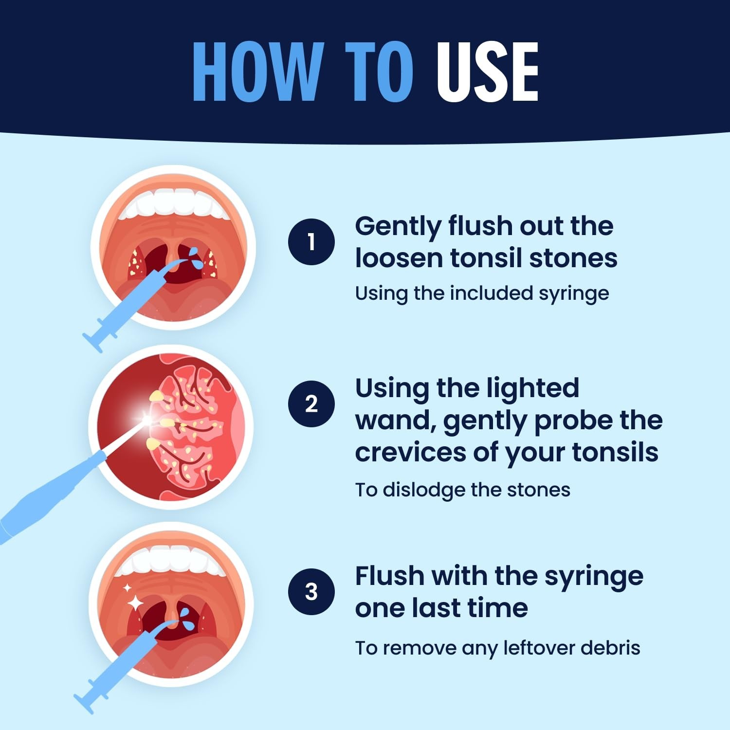 Dr. Frederick’S Original Easy Tonsil Stone Remover Kit - Fast Painless Tonsillol Dr. Frederick’S Original Easy Tonsil Stone Remover Kit - Fast Painless Tonsillol