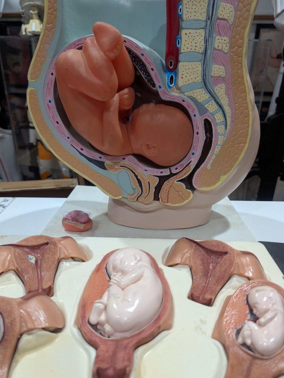 Vintage Obstetrical Pregnancy & Fetal Development Teaching Models w/ 1962 book Vintage Obstetrical Pregnancy & Fetal Development Teaching Models w/ 1962 book