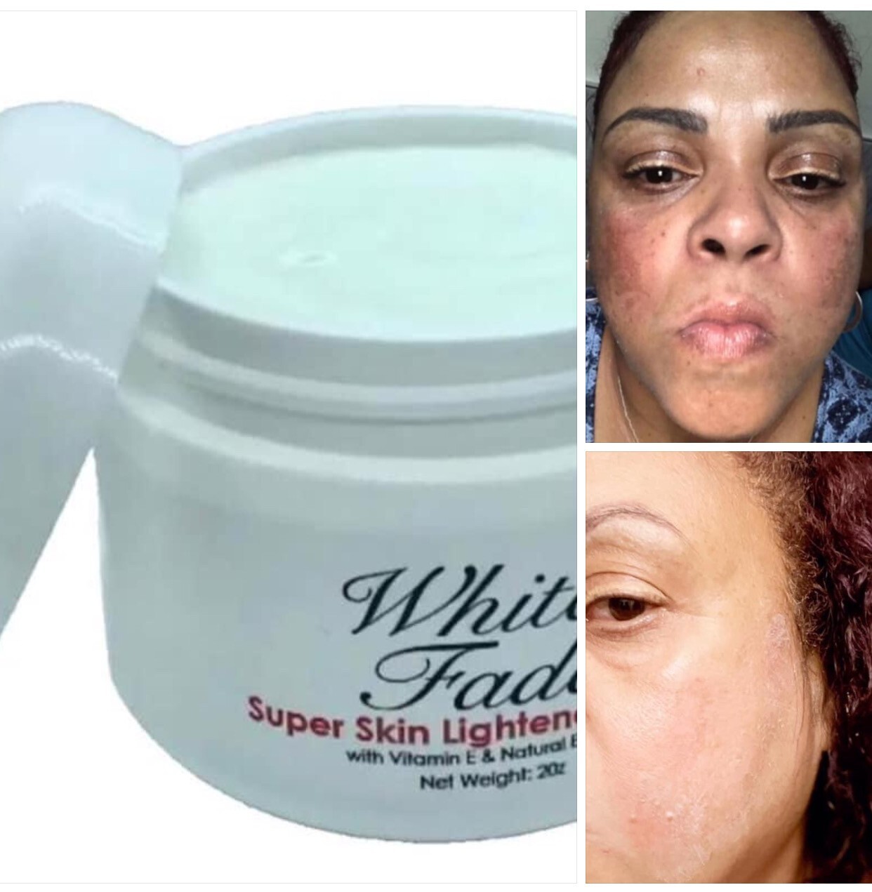 WHITE FADE SUPER SKIN LIGHTENER; PARA REMOVER  MANCHAS  OSCURAS DE LA PIEL, 2oz