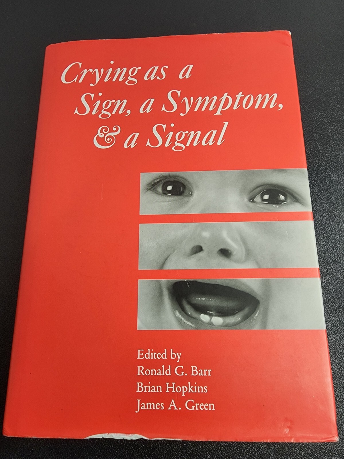 Crying As a Sign, a Symptom, and a Signal : Clinical, Emotional and Development Crying As a Sign, a Symptom, and a Signal : Clinical, Emotional and Development