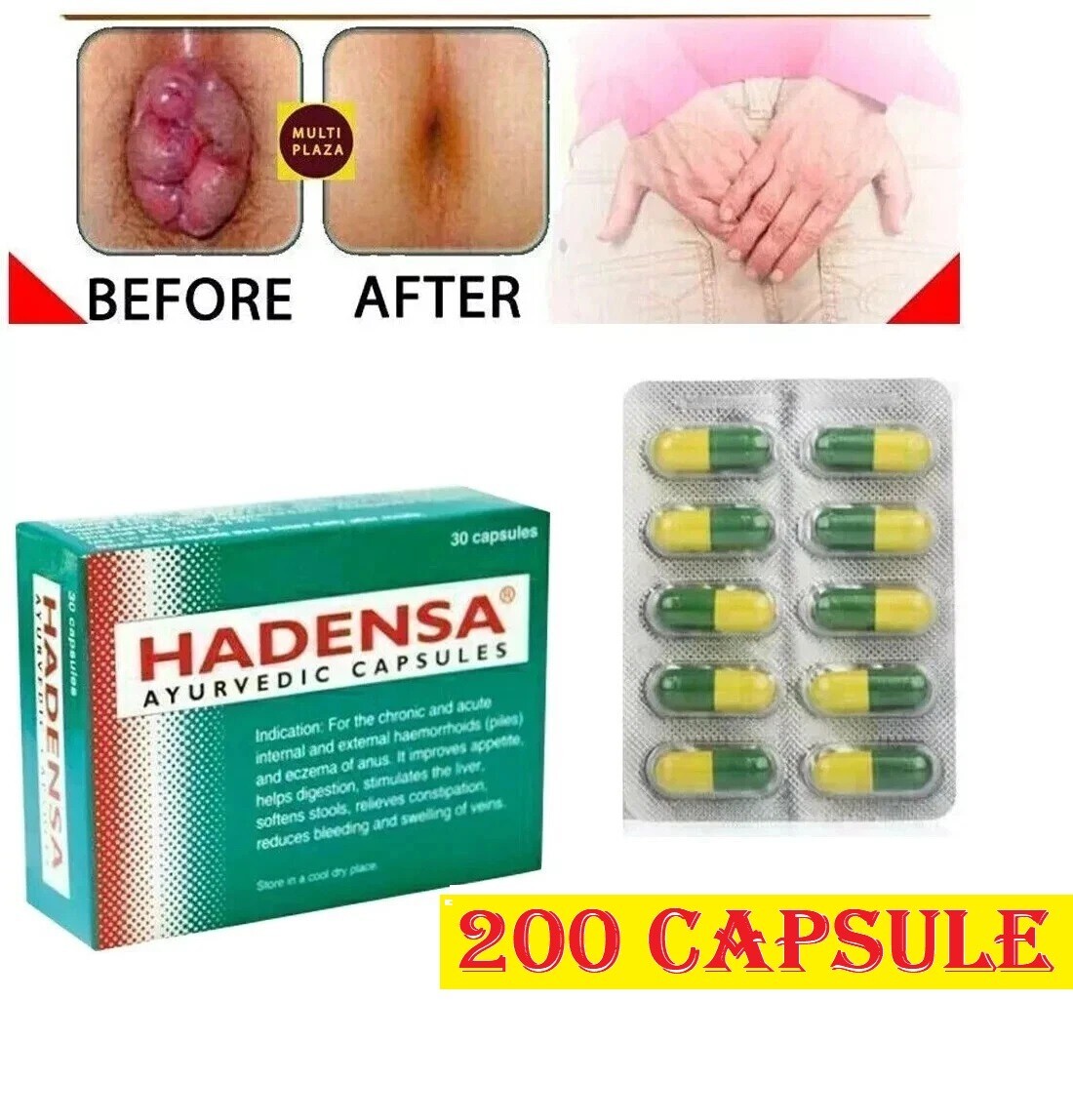 Hadensa 200 Caps for Piles, Haemorrhoids, Fissures & Fistula | Exp - 11/2028