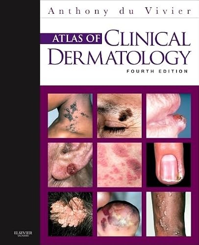 Atlas of Clinical Dermatology (du Vivier, Atlas of Clinical De... Atlas of Clinical Dermatology (du Vivier, Atlas of Clinical De...