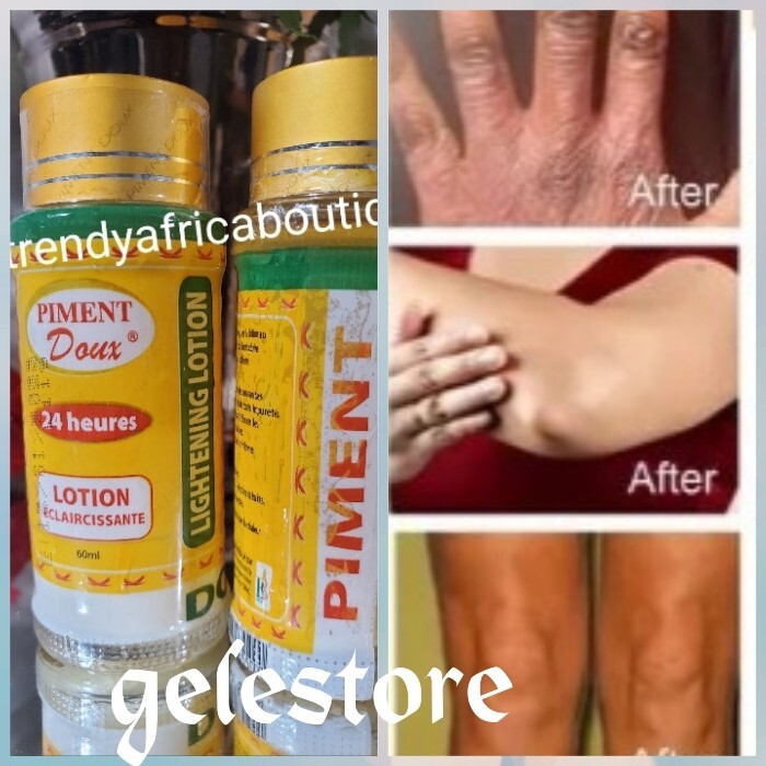 X 2 Pment Lightening Lotion (Cleanser) KNUCKLES, KNEES & elbow. 60ml X 2 X 2 Pment Lightening Lotion (Cleanser) KNUCKLES, KNEES & elbow. 60ml X 2
