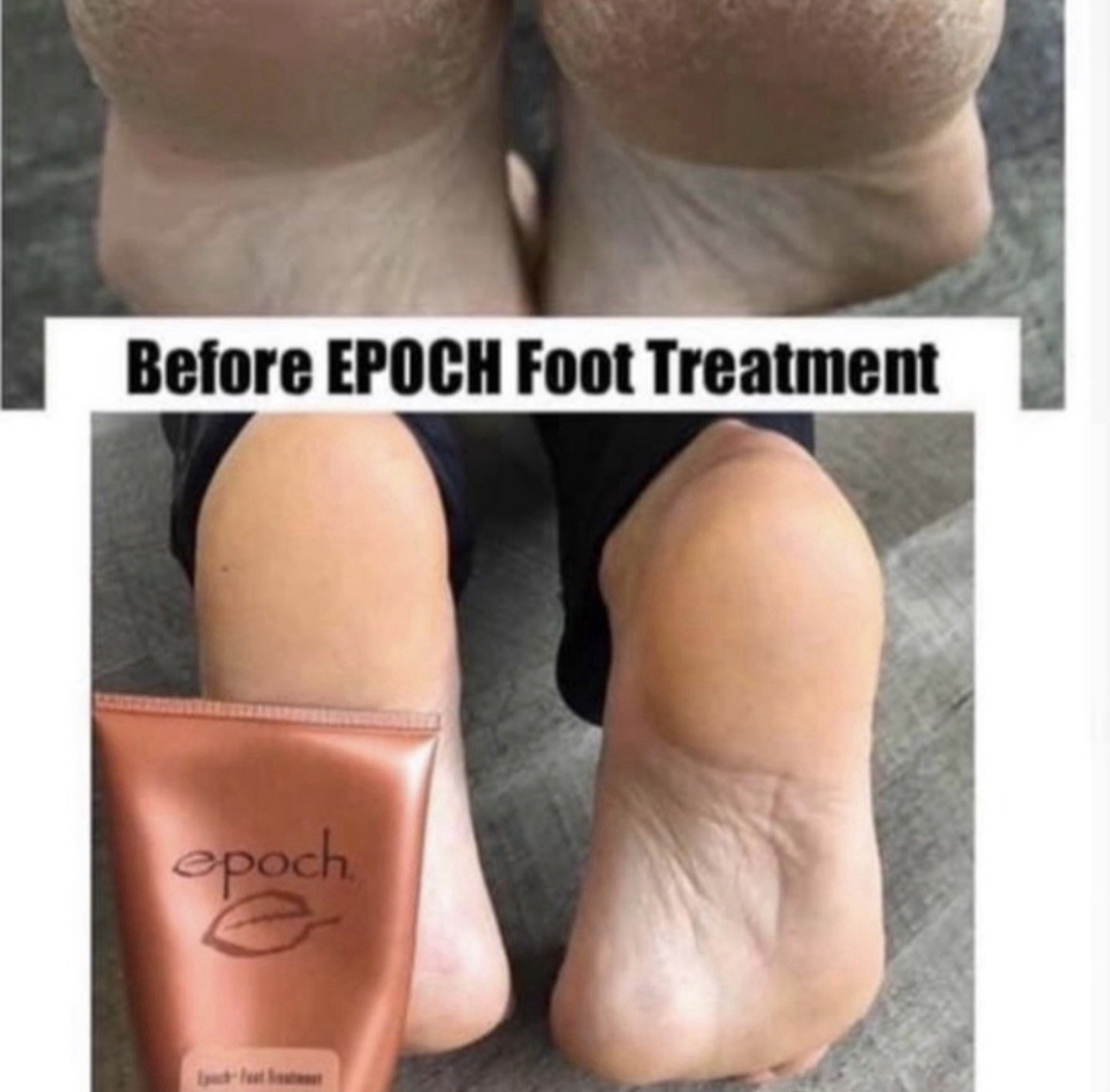 New Epoch Sole Solution Foot Treatment 4 Oz-Free Shipping