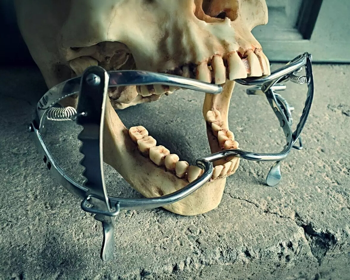 Medical Mouth Gag, Mouth Spreader Display, Vintage Medical Style, Oddities