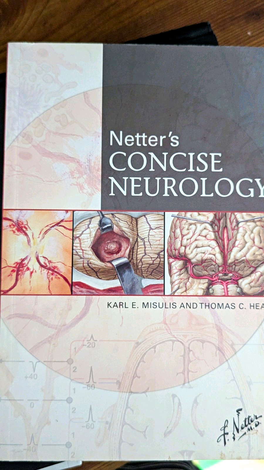 Netter\'s Concise Neurology Karl E. Misulis & Thomas C. Head PB 2007 Netter\'s Concise Neurology Karl E. Misulis & Thomas C. Head PB 2007