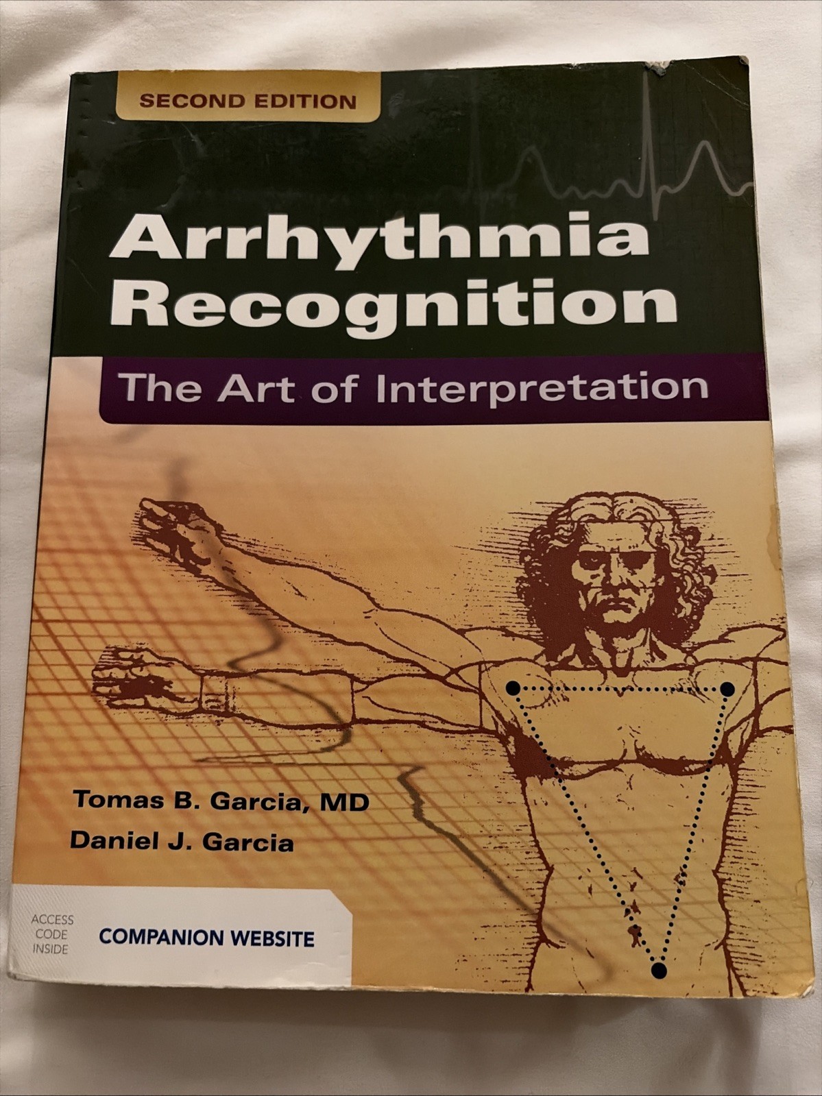Arrhythmia Recognition : The Art of Interpretation by Daniel J. Garcia and Tomas Arrhythmia Recognition : The Art of Interpretation by Daniel J. Garcia and Tomas