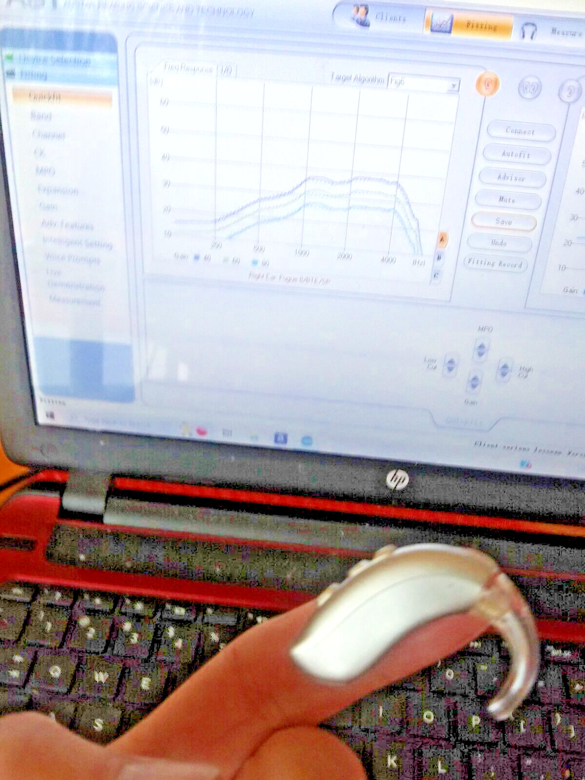 PROGRAMMABLE BEHIND THE EAR DIGITAL HEARING AID PROFOUND hearing loss BUY USA PROGRAMMABLE BEHIND THE EAR DIGITAL HEARING AID PROFOUND hearing loss BUY USA