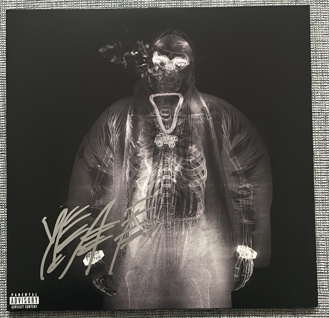 YEAT RAPPER SIGNED AUTOGRAPHED “AFTERLYFE” VINYL LP RECORD ALBUM - BECKETT COA YEAT RAPPER SIGNED AUTOGRAPHED “AFTERLYFE” VINYL LP RECORD ALBUM - BECKETT COA