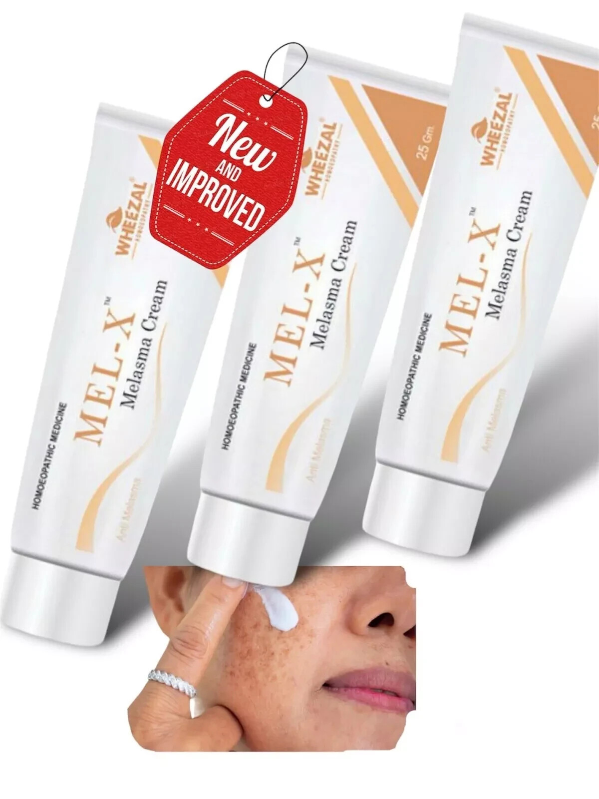 3 X 25g Wheezal Mel-X Melasma Cream Pigmentation Tanning Aging Sunburn Melasma