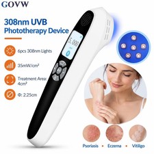 308nm Narrowband UVB Excimer Light Therapy Device Targeted Skin Treatment Home picture