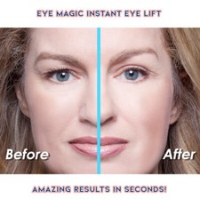 Eye Magic Premium Instant Eye Lift Strips Droopy Hooded Eyelids Made in America picture