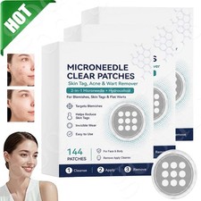 Curalona Microneedle Patches 144pcs, Skin Tag Wart Acne Remover Patches ~20% OFF picture