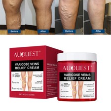 Varicose Veins Relief Cream Relieve Tired Legs Spider Pain Tighten Smooth Skin picture
