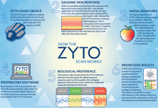 Zyto Select Software License + Hand Cradle – BEST PRICE ONLINE – Fast Shipping picture
