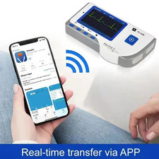 ECG Monitor for Home Care  2.8-inch TFT Display  Multi-Site Monitoring picture