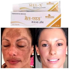 Wheezal Mel-X Melasma Cream (25g) for skin pigmentation like melasma, chloasma picture