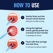 Dr. Frederick’S Original Easy Tonsil Stone Remover Kit - Fast Painless Tonsillol picture