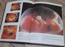 Book 1974 Vintage Bordas Sexuality Focus Encyclopedia Gynecology Sciences Earth  picture