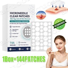 Curalona Microneedle Patches 144pcs, Skin Tag Wart Acne Remover Patches,Hot Sale picture