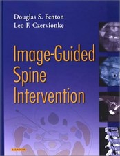 Image-Guided Spine Intervention picture