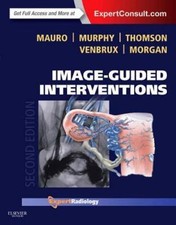 Expert Radiology: Image-Guided Interventions by Robert A. Morgan, Kieran P.... picture