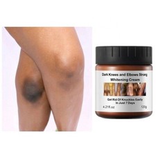 New Strong Whitening Cream For Removing Dark Knuckle Finger Elbow and Knee picture