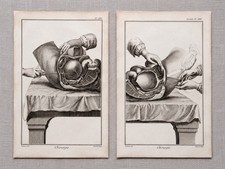 Pair 18thC Diderot Encyclopandie Surgical Engravings Chirurgie Medical Plates picture