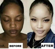 2*Skin Lightening Cream Extra Strength Lighter FAST Result-NO SIDE EFFECTS picture