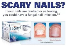 Nail Fun-gal Lacquer 2.5ML FREE & FAST DELIVERY picture