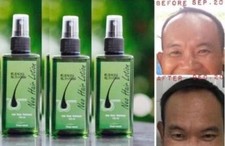 3x Neo Hair Lotion 120 ml Hair Treatment Root Nutrients Herb Effective 100% picture