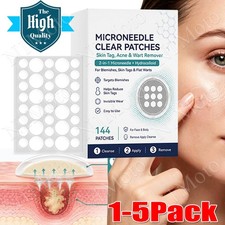Curalona Microneedle Patches 144pcs, Skin Tag Wart Acne Remover Patches 1-5Box picture